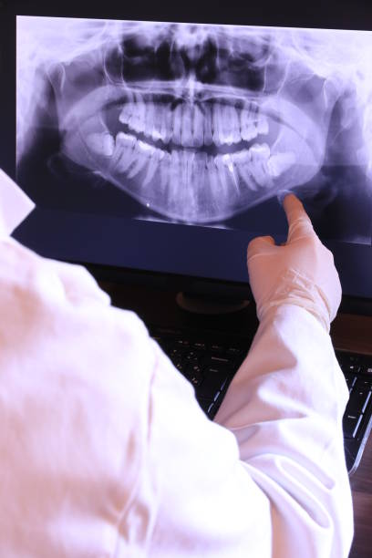 Best Chipped Tooth Repair Near Me  in Coeur Dalene, ID